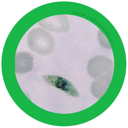 Giant Microbes Original Malaria - Planet Microbe