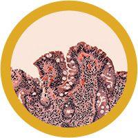 Giant Microbes Celiac Disease - Planet Microbe