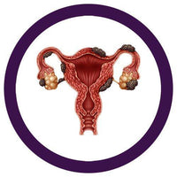 Giant Microbes Original Endometriosis (Uterus)