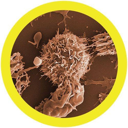 Giant Microbes Leukemia Cancer - Planet Microbe
