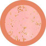 Giant Microbes Original Acne Pimple (Propionibacterium Acnes) - Planet Microbe